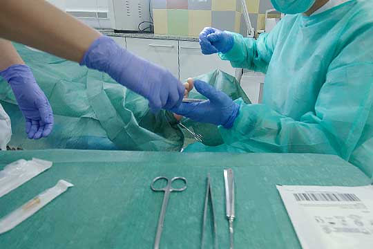 Cirugia del Pie en una Uña Encarnada